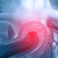 Disecția aortică: o urgență medicală serioasă